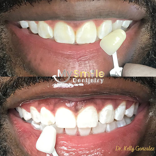 My Smile Dentistry | Dentures, Sealants and Laser Dentistry