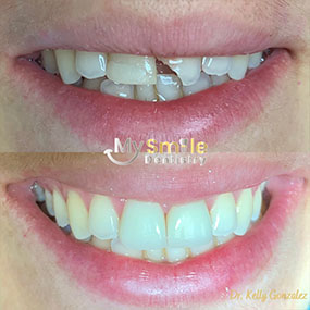 My Smile Dentistry | Orthodontics, Veneers and ClearCorrect®