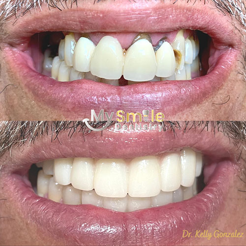 My Smile Dentistry | Smile Makeover, Teeth Whitening and Laser Dentistry
