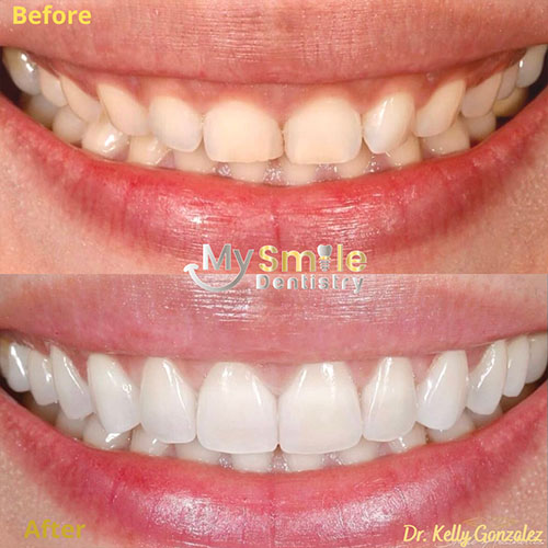 My Smile Dentistry | Emergency Dental Care, Smile Makeover and Oral Surgery