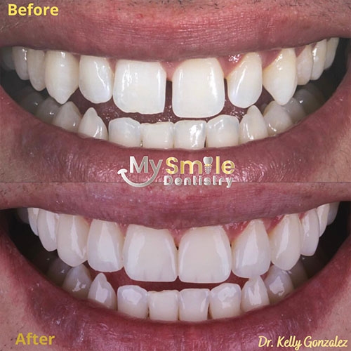 My Smile Dentistry | Orthodontics, Laser Gum Surgery and Lumineers®