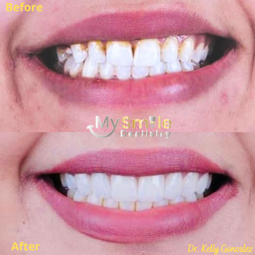 My Smile Dentistry | Periodontal Treatment, Laser Gum Surgery and Pediatric Dentistry