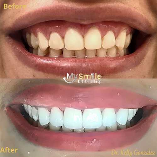 My Smile Dentistry | Root Canals, Teeth Whitening and Sedation Dentistry